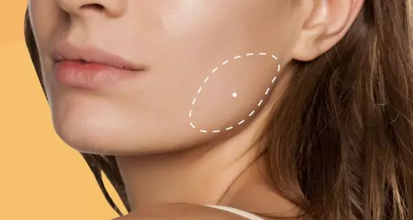 What are the therapeutic benefits of Botox in dentistry?