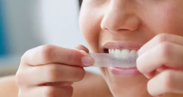 What precautions should you take before whitening?