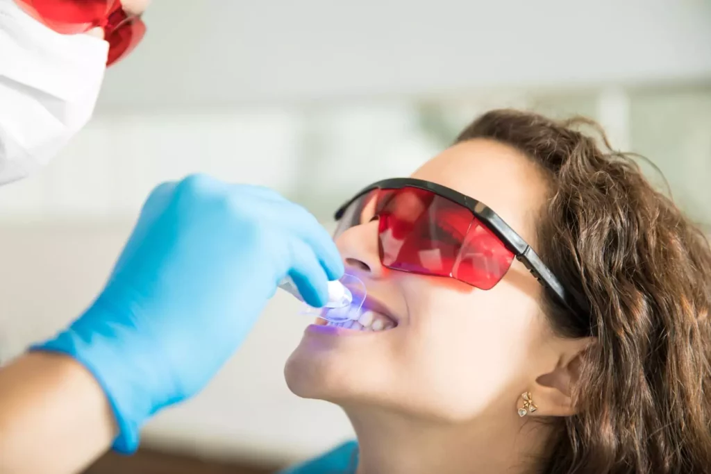 ¿Cuándo el blanqueamiento dental es malo para tu salud?