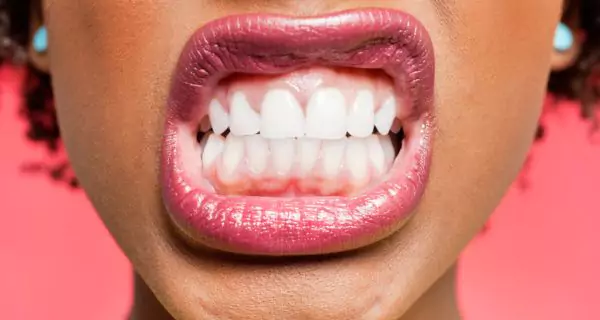 How is bruxism connected to drug use?