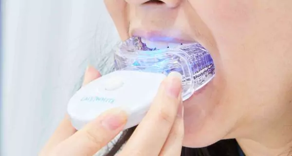 How should you use tooth whitening kits safely?