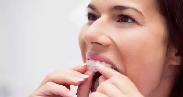 How to use mouthguards for teeth grinding effectively?