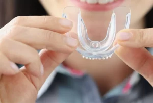 ¿Qué protectores bucales para bruxismo son más recomendados?