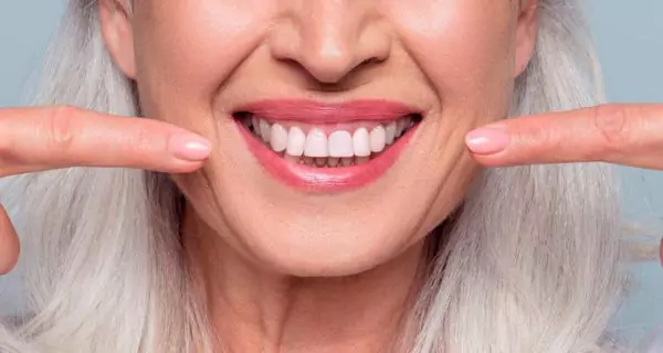 ¿Qué es y cómo funciona el blanqueamiento dental?
