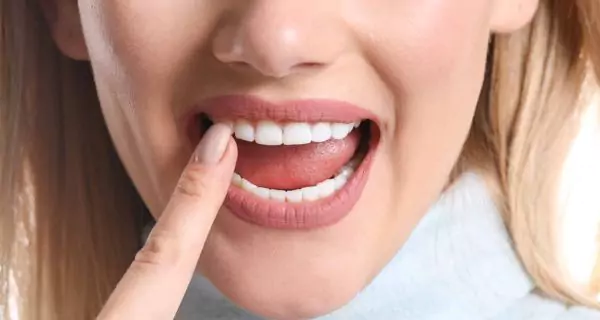 What are the real oral health benefits of stannous fluoride?