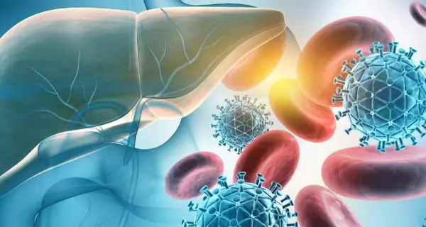 What is viral hepatitis? | Hepatitis A