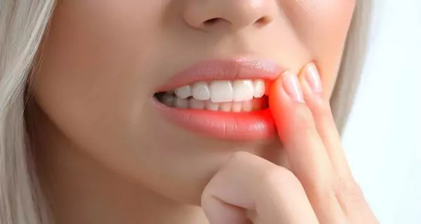 What should you do if you have a soft tissue injury (gums, lips, or tongue)?