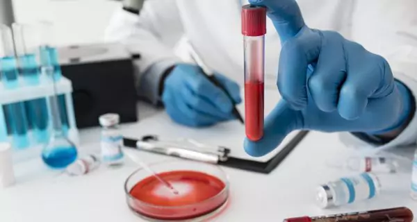 What should you tell your dentist if you have hepatitis? | ¿Qué debe hacer el odontólogo al tratar a un paciente con hepatitis?