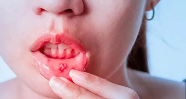 Why were some toothpastes recalled recently?