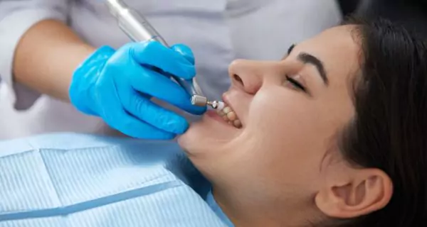 How is teeth polishing done at the dentist?