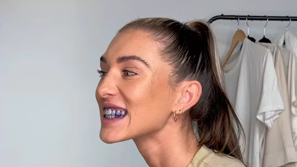 How Does Purple Teeth Whitening Remove Yellow Stains?