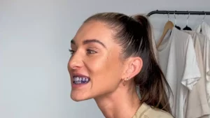 How Does Purple Teeth Whitening Remove Yellow Stains?