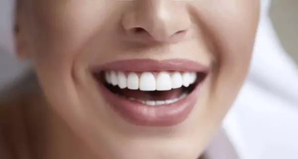 What are the benefits of teeth polishing?