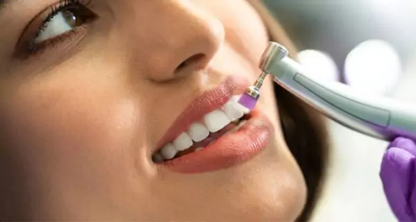What is teeth polishing and why is it performed?