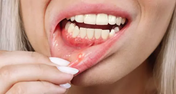 What risks can purple whitening have?