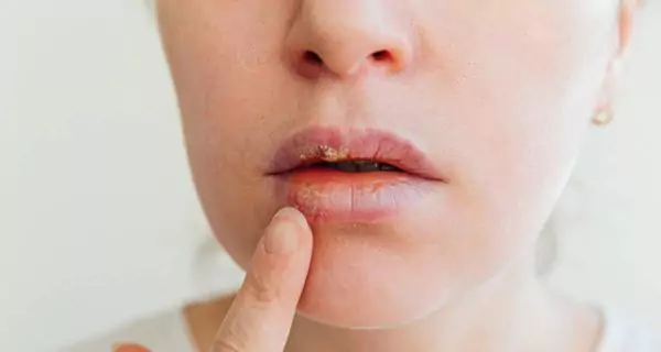 ¿Qué otros beneficios tiene masticar chicle sin azúcar?