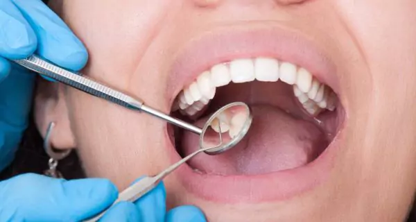 What are the risks and safety concerns of dental grills?