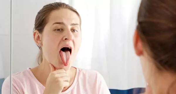 What causes pain in the roof of the mouth?