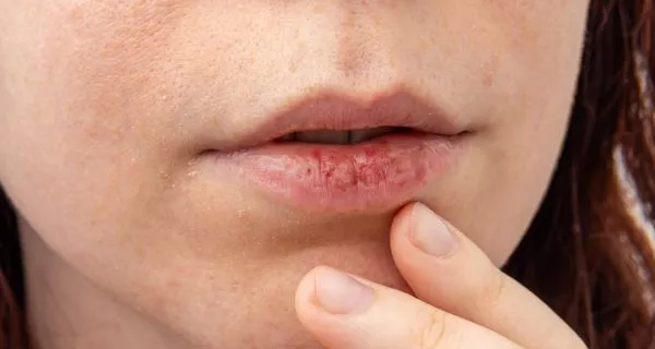 How exactly does Ozempic affect oral health?