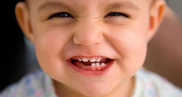 ¿Por qué cuidar los dientes de leche?