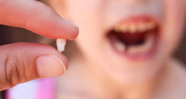 ¿Por qué se caen los dientes de leche?