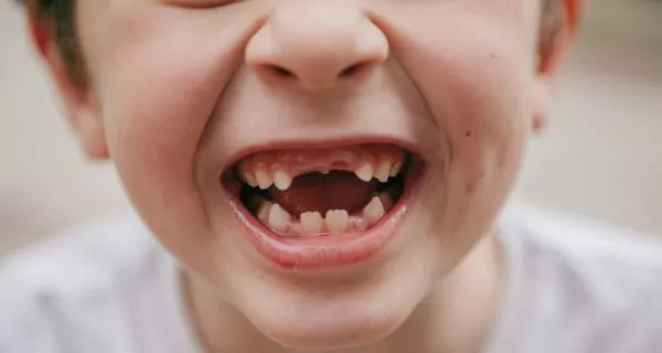 Which baby tooth falls out first?