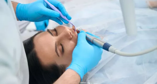 What Is Trench Mouth and Why Is It Dangerous? 12 How is trench mouth treated?