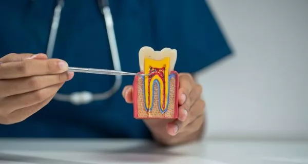 What is a root canal? understanding the procedure step by step