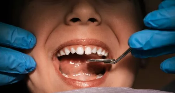 What is the lingual frenulum and why does it matter?